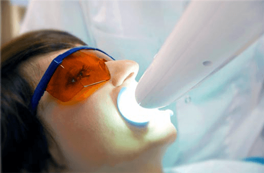 Understanding the Causes of Teeth Sensitivity Redditch