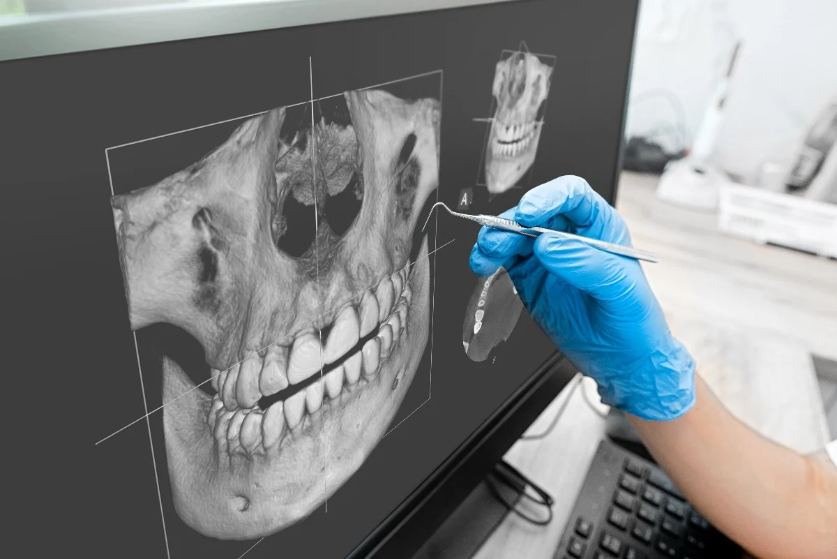 How Is AI Transforming Dental Treatment Planning Redditch?