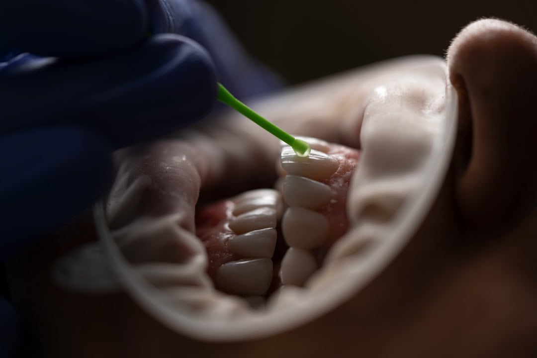 The Role of Saliva: Nature’s Defense System Redditch