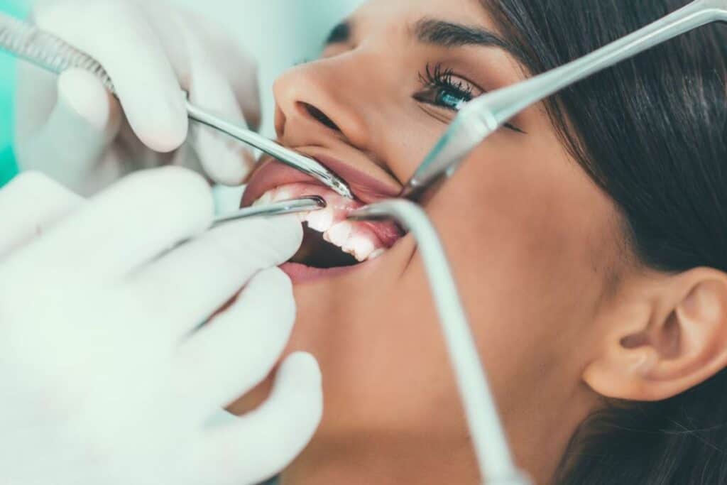 Braces Are Just for Kids – Myth or Reality Redditch