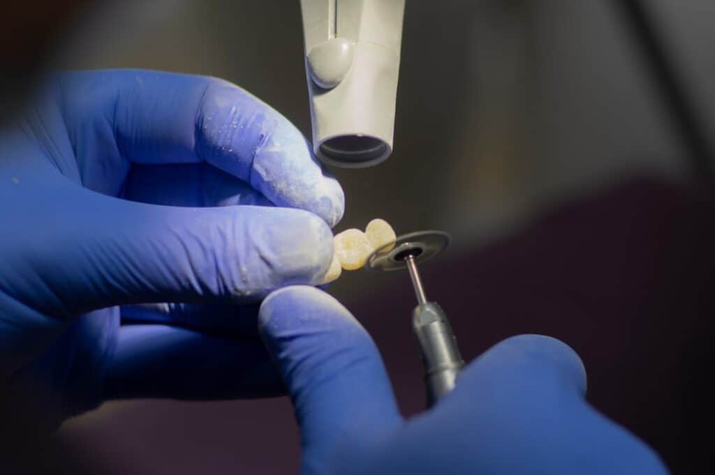 Customised Dental Solutions: Crowns, Aligners, and Implants Redditch