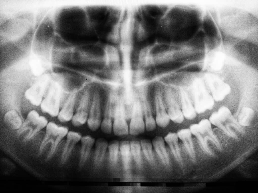 The Future of 3D Printing in Oral Healthcare Redditch