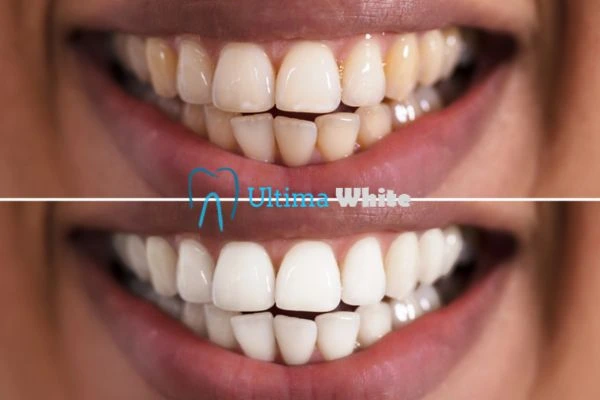 Long lasting results from Ultima White Redditch